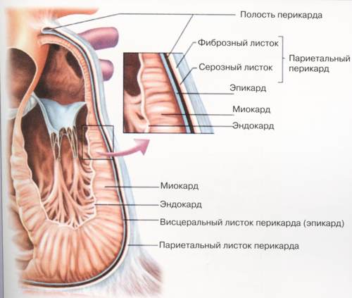 Эндокардит