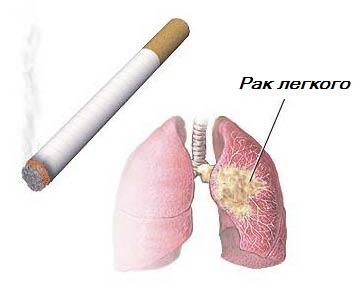 lung_cancer.jpg
