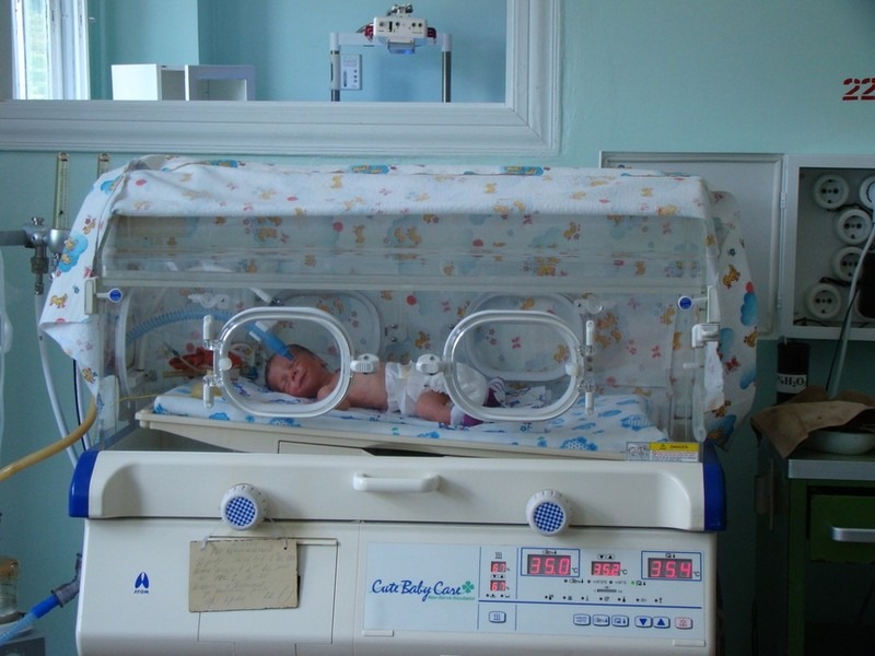Разделили новорожденных сиамских близнецов