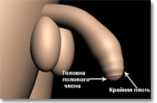 Красные пятна на головке пениса – причины, симптомы и лечение | Медцентр Лекарь в Красногорске